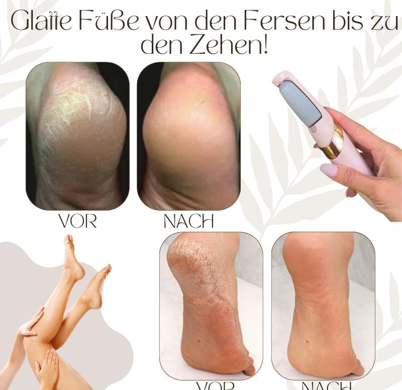 Lisslune | Callusos – Electric Callus Remover