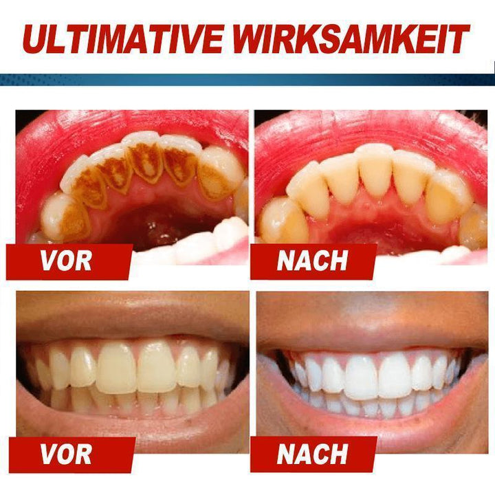 Lisslune | Intensive Stain Removal Whitening Toothpaste