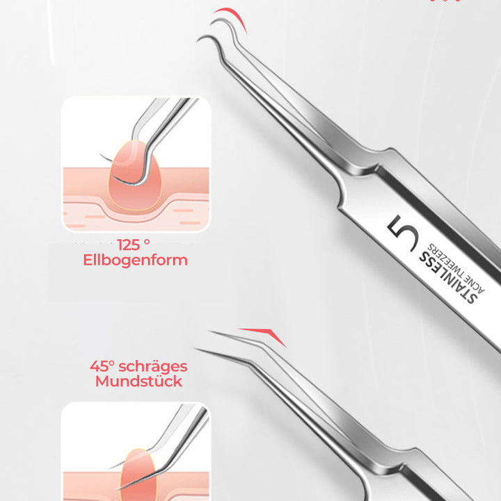 Lisslune | Tweezer for Removing Blackheads on the Face