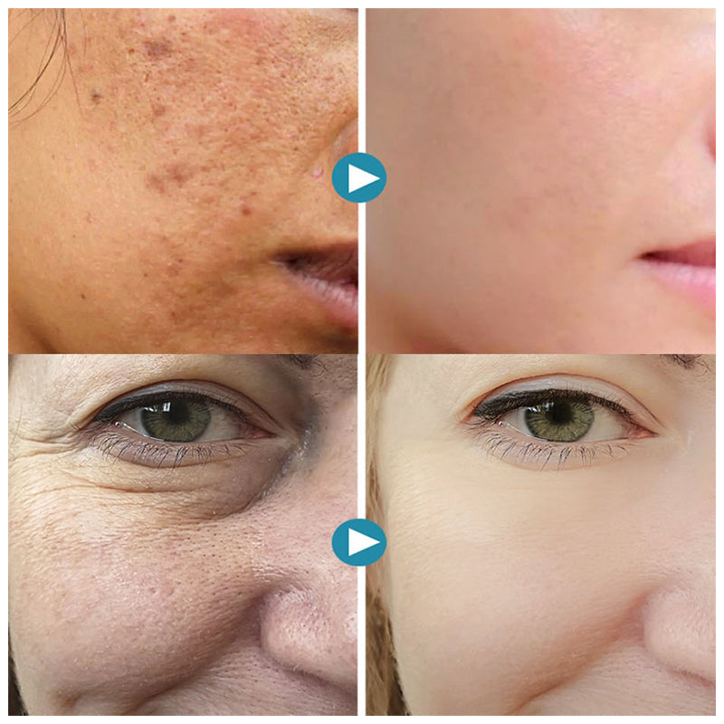 Lisslune | Invisible Pores Concealer