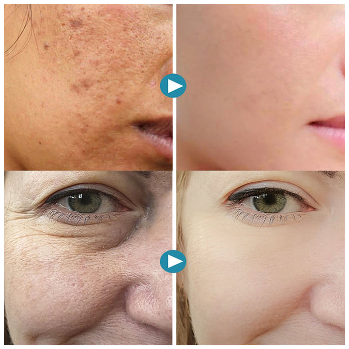 Lisslune | Invisible Pores Concealer