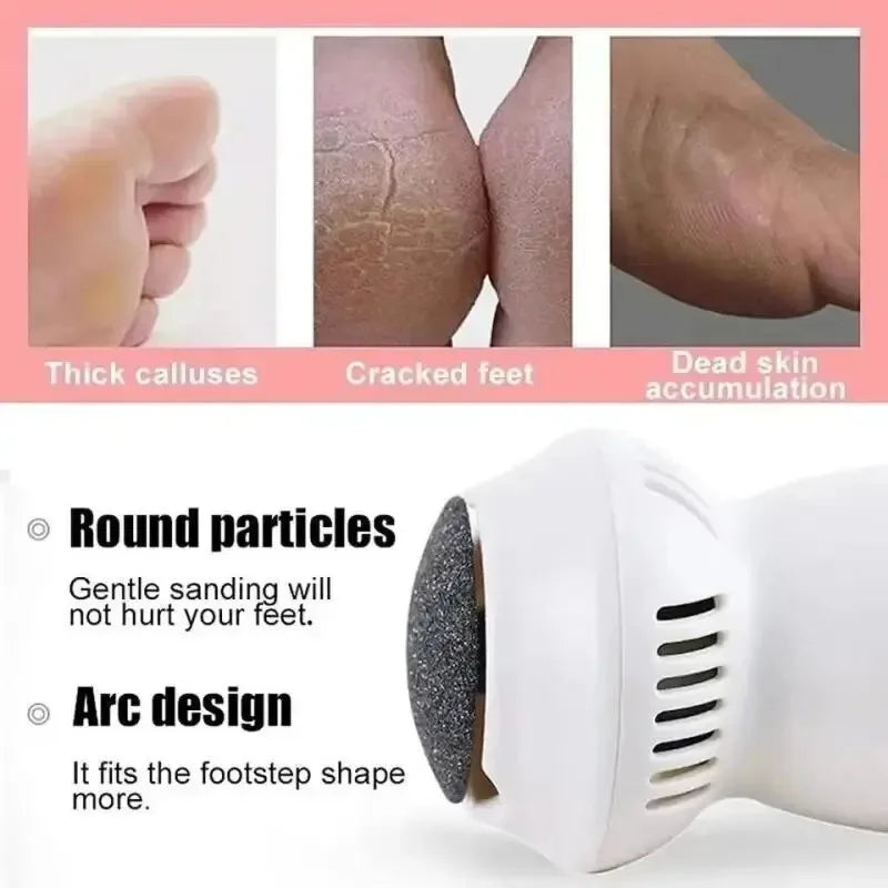 Lisslune | Electric Professional Callus Remover
