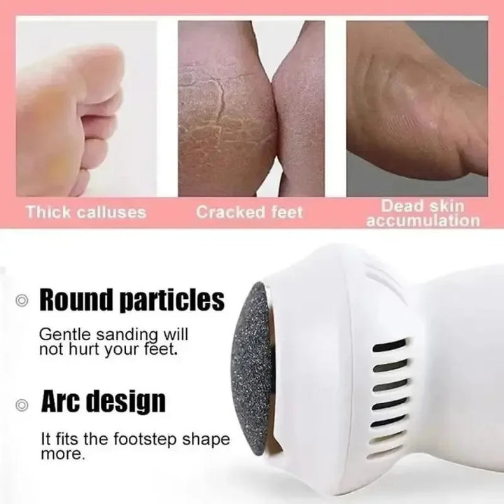Lisslune | Electric Professional Callus Remover
