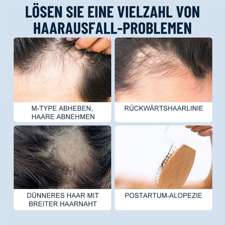 Lisslune | Scalp Care Hair Growth Spray