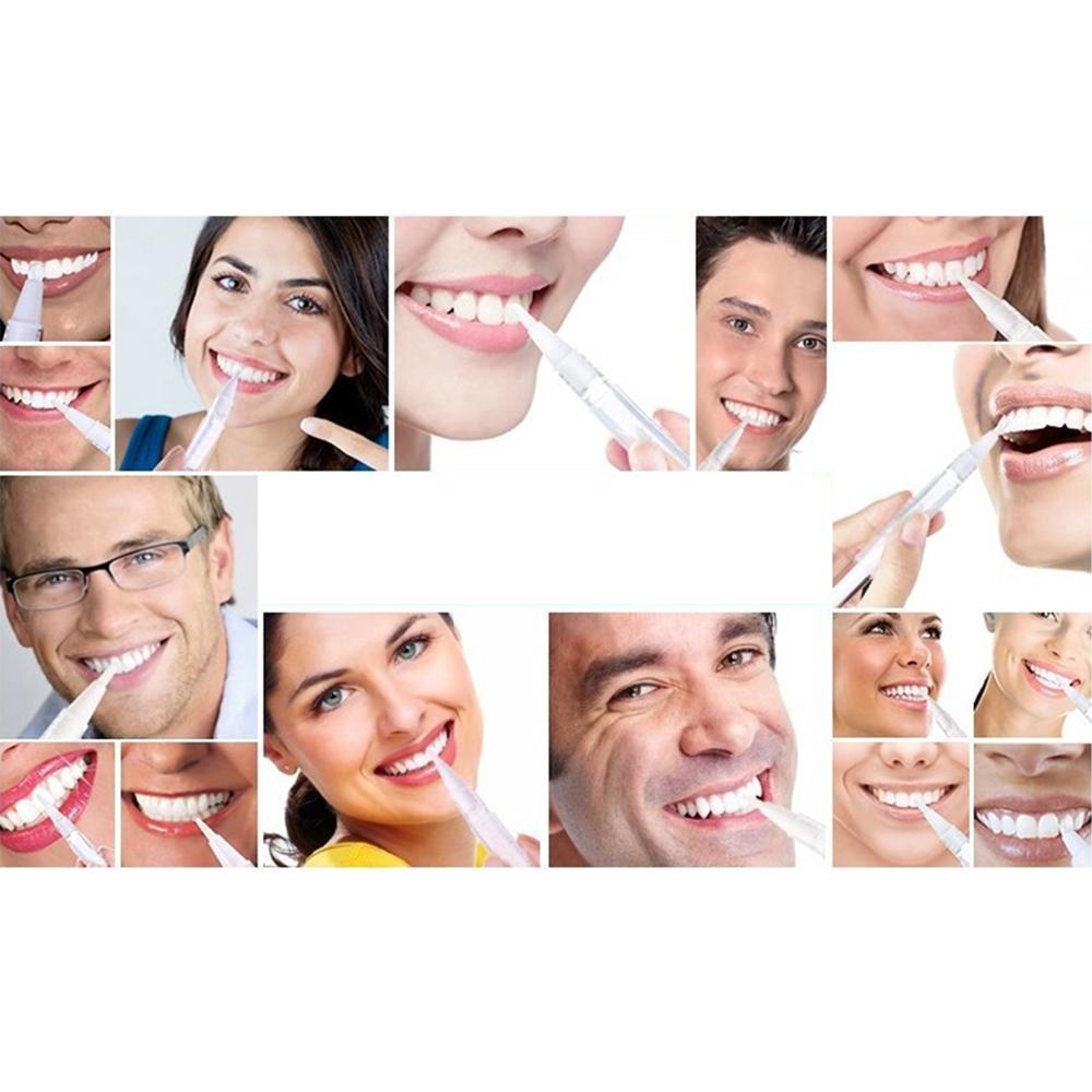 Lisslune | Bequee perfect teeth whitening pen