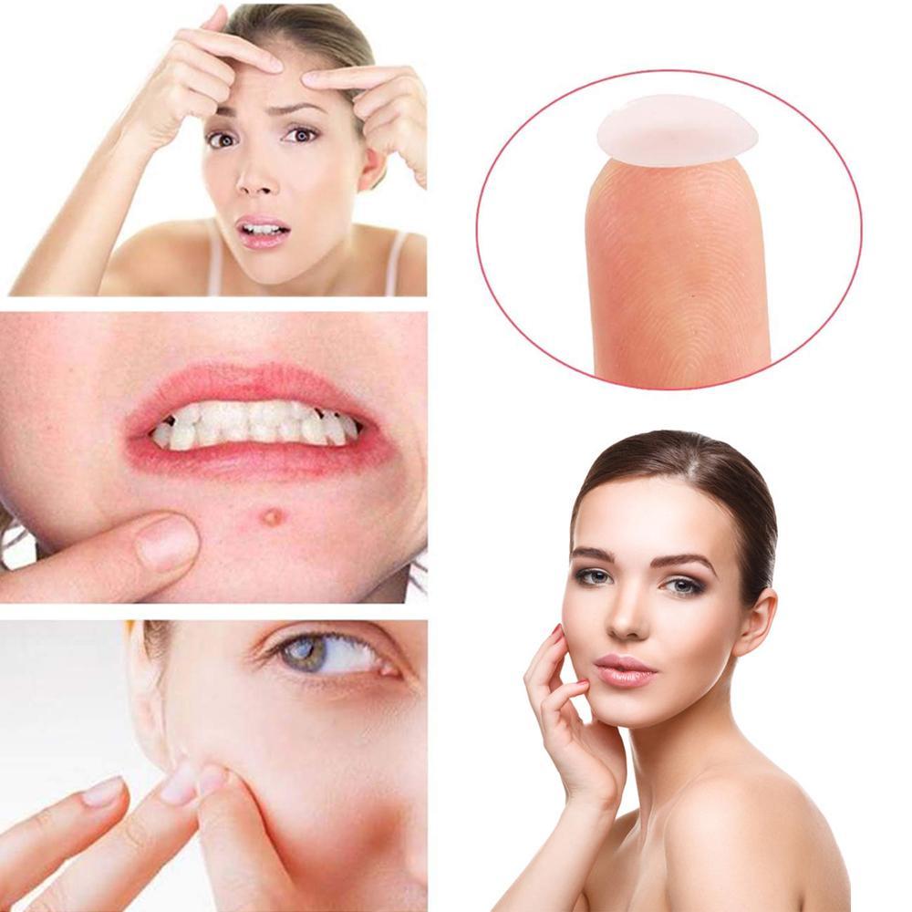Lisslune | Acne Stickers, 30 pieces