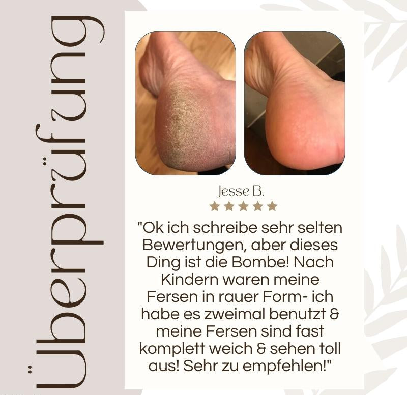 Lisslune | Callusos – Electric Callus Remover