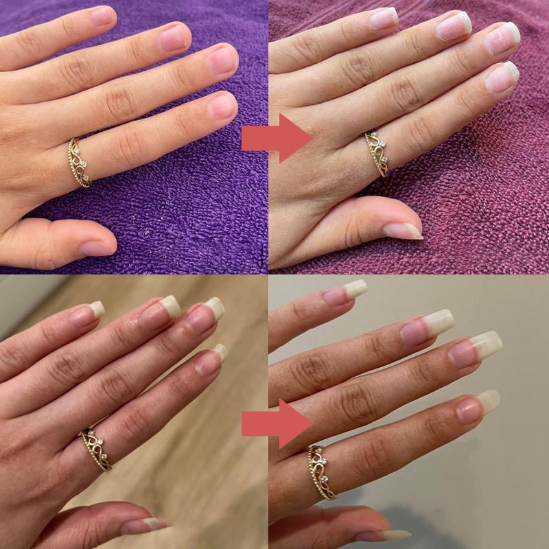 Lisslune | Nails Nutrient-Rich Growth Oil