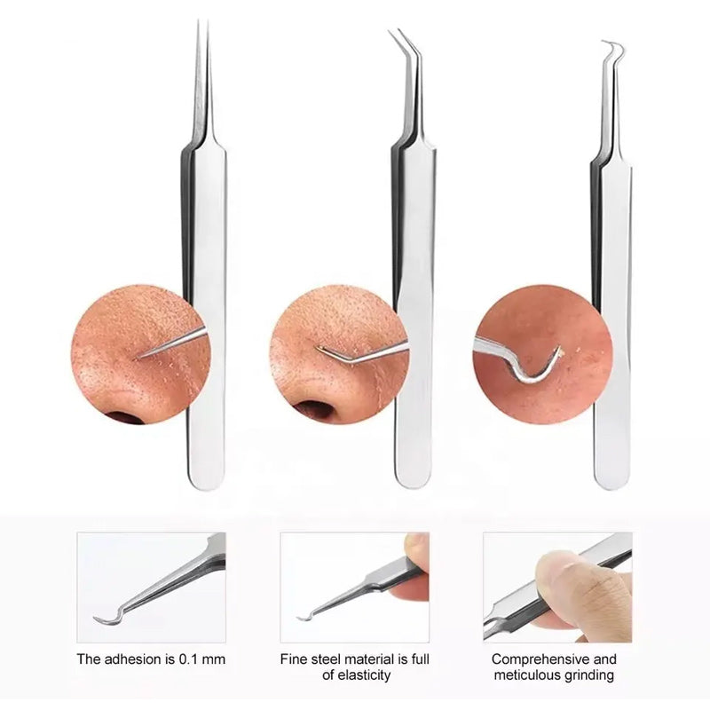 Lisslune | Tweezer for Removing Blackheads on the Face
