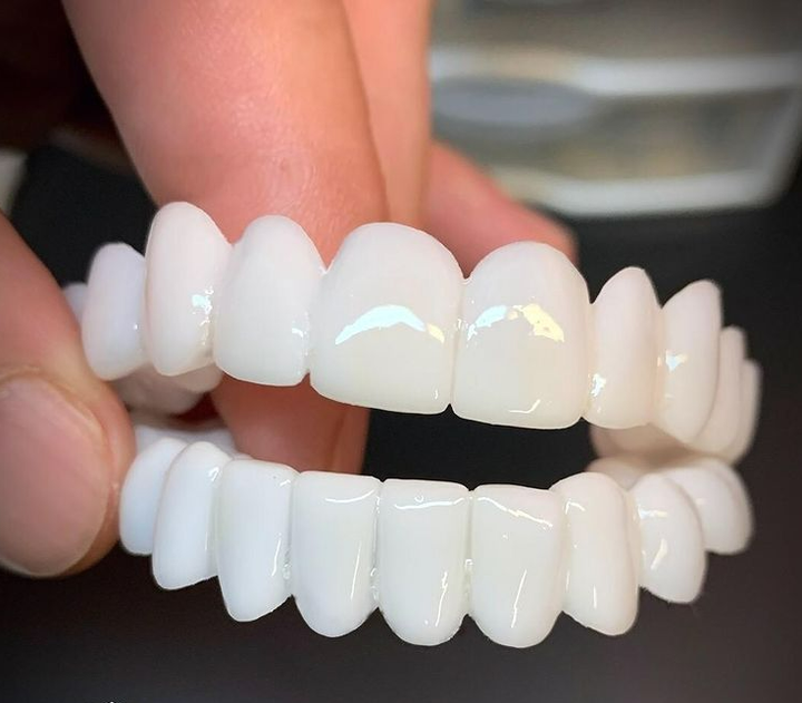 Lisslune | Dental prosthesis