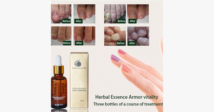 Lisslune | Wonder Nail Essence – The best solution for healthy nails