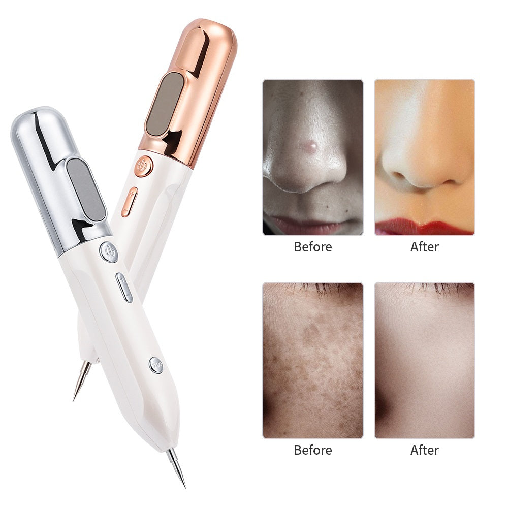 Lisslune | HexoPen️ Wart & Skin Tag Removal Plasma Pen
