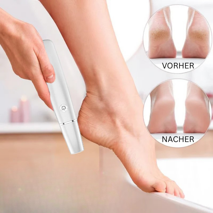 Lisslune | Electric Callus Remover for the Feet