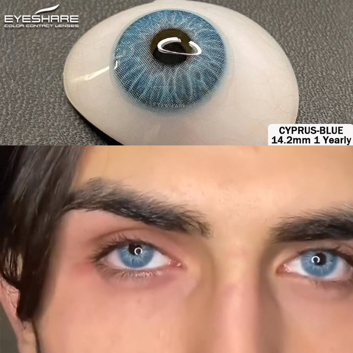 Rynx Cyprus Blue 14.2mm 1 Pair | 1 Year