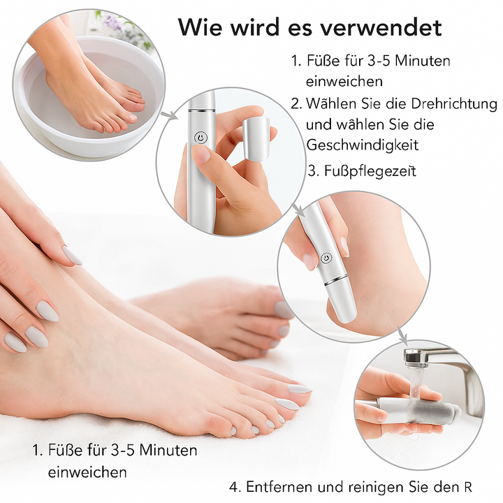 Lisslune | Electric Callus Remover for the Feet