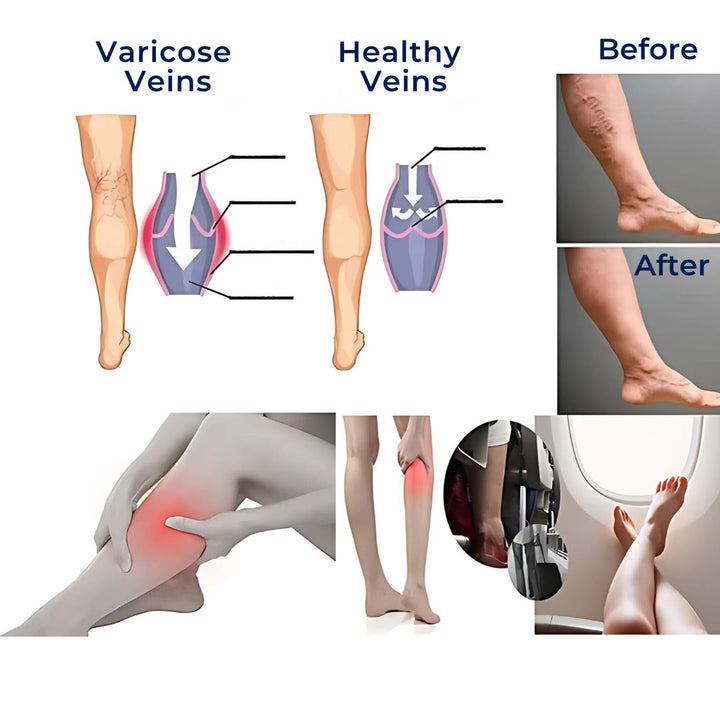 Lisslune | CircuEase Compression Socks | Soft, Highly Elastic Design for Muscle Recovery & Circulation Enhancement for Professionals on Their Feet