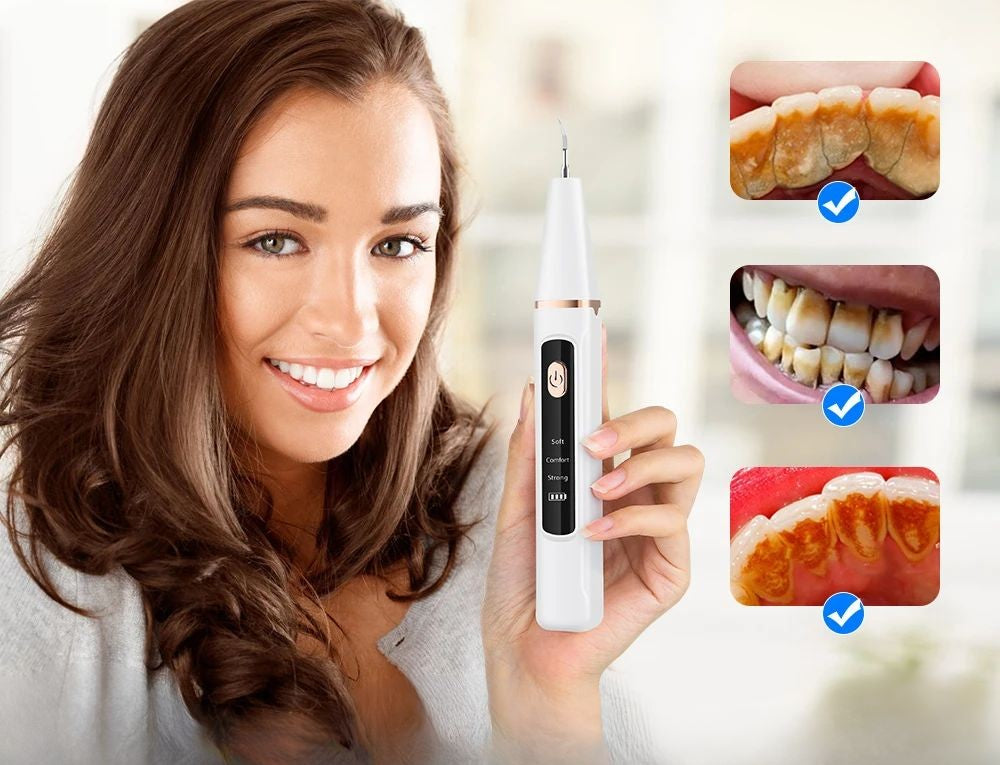 Lisslune | Ultrasonic Teeth Cleaning Device | 38 kHz Ultrasound, LED Light & USB Fast Charging for Home Dental Care