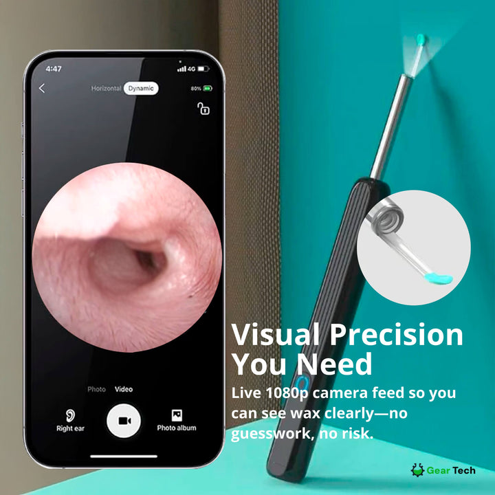 Lisslune | EarScope Pro Ear Wax Removal Kit | High-Resolution Camera & LED Lights for Safe Home Use