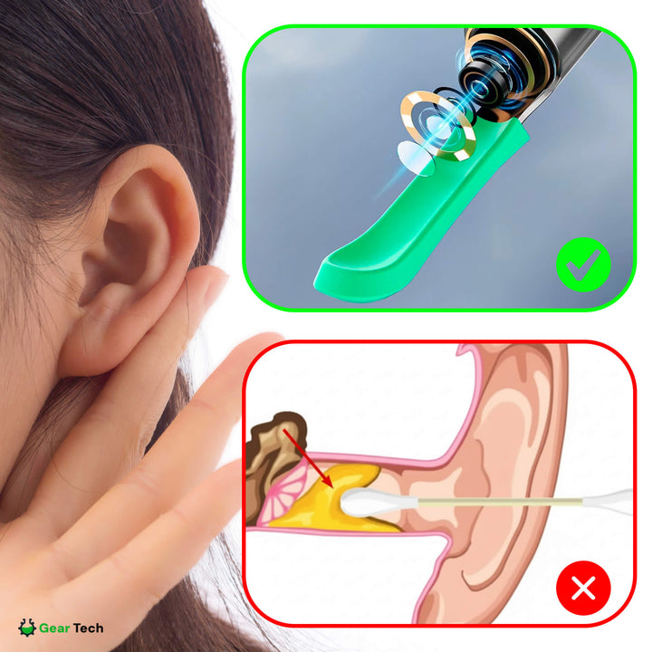 Lisslune | EarScope Pro Ear Wax Removal Kit | High-Resolution Camera & LED Lights for Safe Home Use