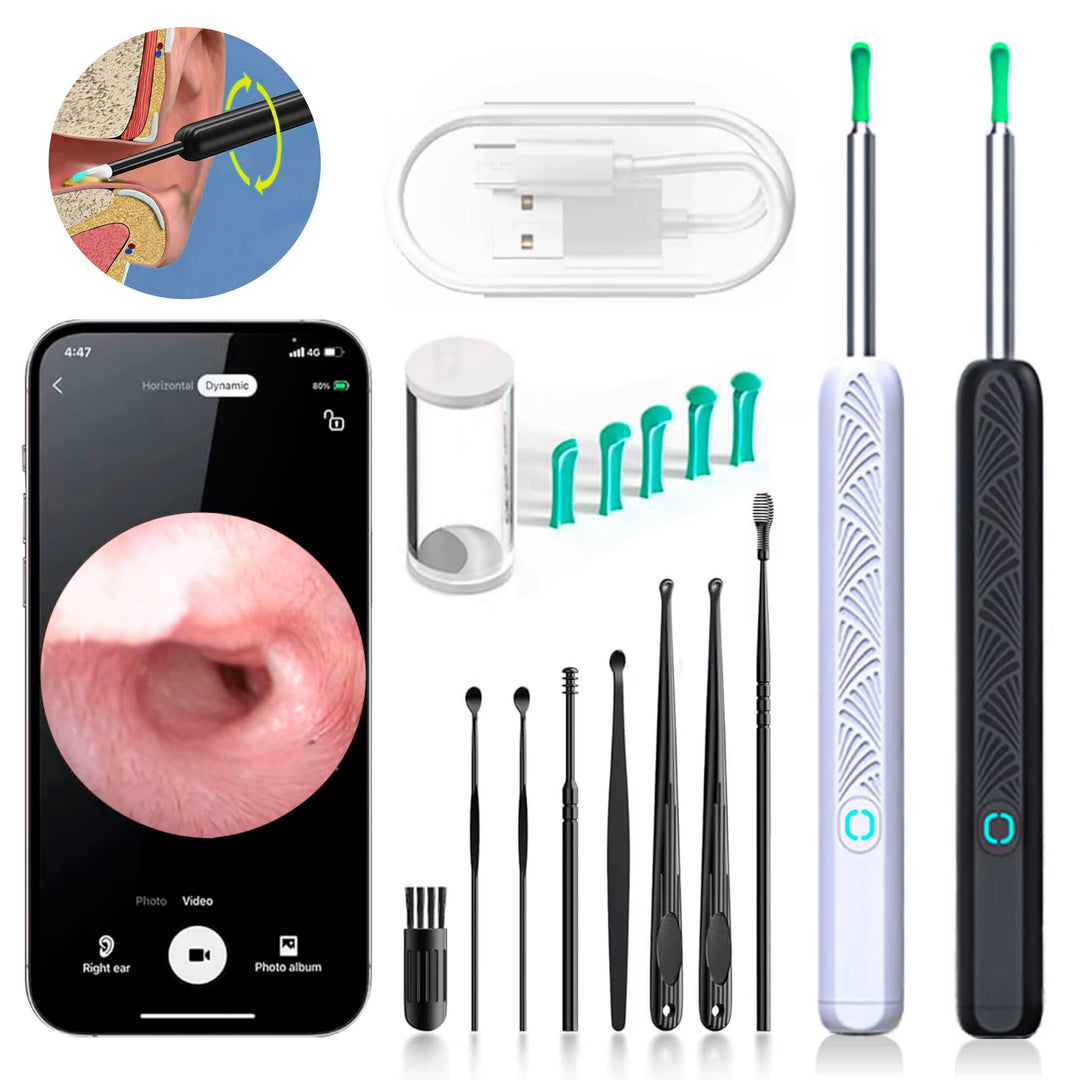 Lisslune | EarScope Pro Ear Wax Removal Kit | High-Resolution Camera & LED Lights for Safe Home Use