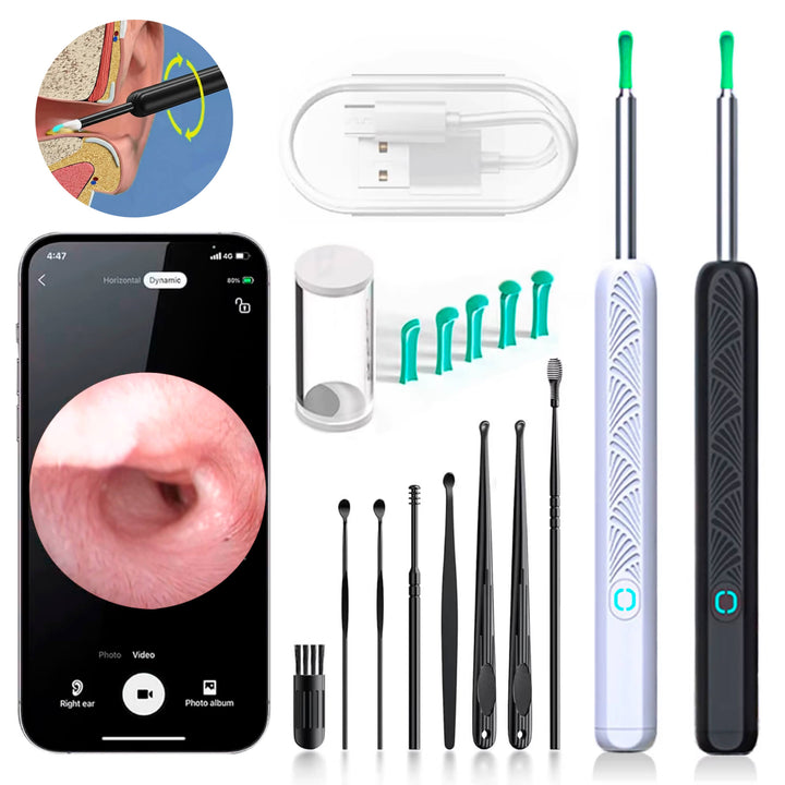 Lisslune | EarScope Pro Ear Wax Removal Kit | High-Resolution Camera & LED Lights for Safe Home Use