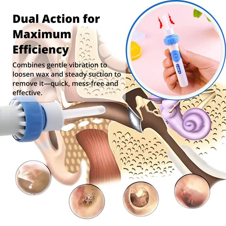 Lisslune | Electric Ear Suction Wax Removal Tool | Ergonomic, Silicone Tip & Compact Design for Safe Ear Hygiene at Home or Travel
