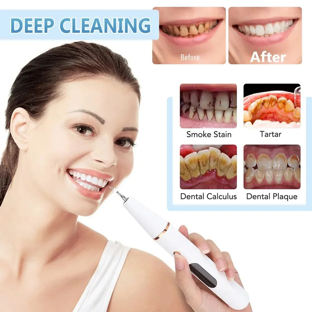 Lisslune | Ultrasonic Teeth Cleaning Device | 38 kHz Ultrasound, LED Light & USB Fast Charging for Home Dental Care