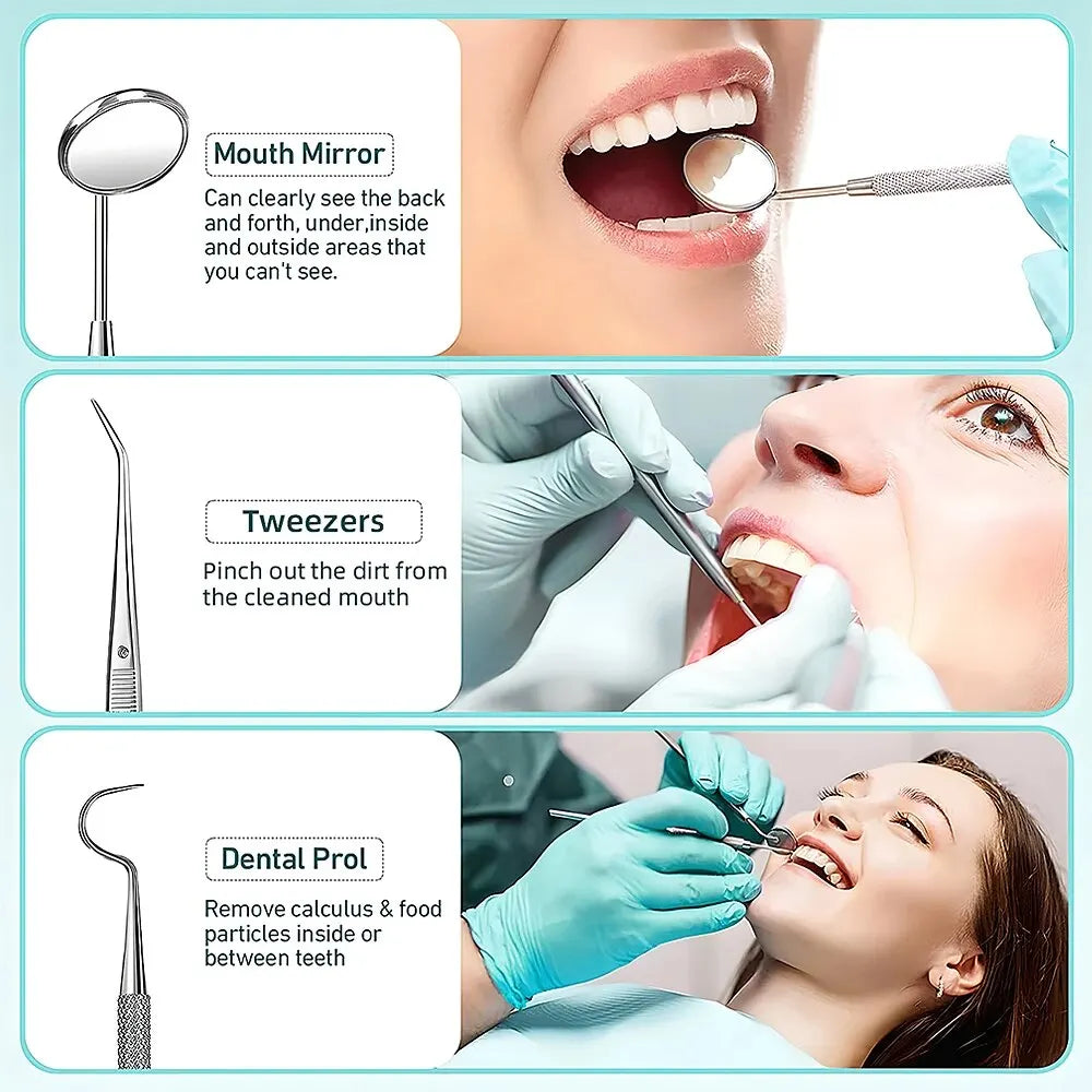 Lisslune | Ultrasonic Teeth Cleaning Device | 38 kHz Ultrasound, LED Light & USB Fast Charging for Home Dental Care