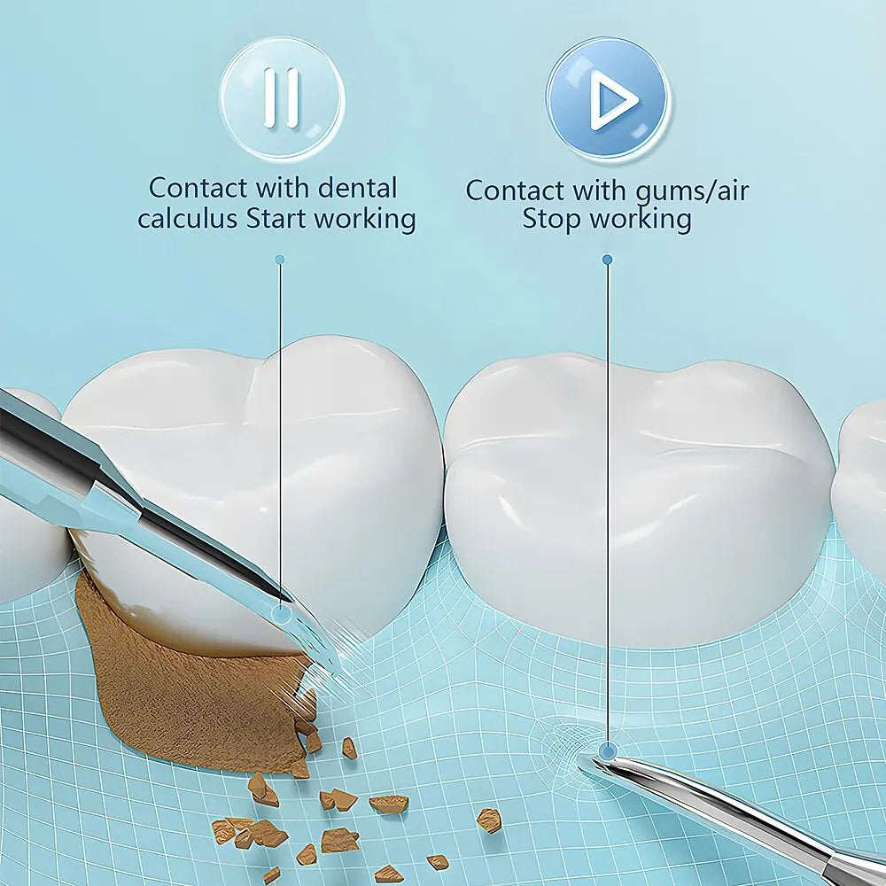 Lisslune | Ultrasonic Teeth Cleaning Device | 38 kHz Ultrasound, LED Light & USB Fast Charging for Home Dental Care