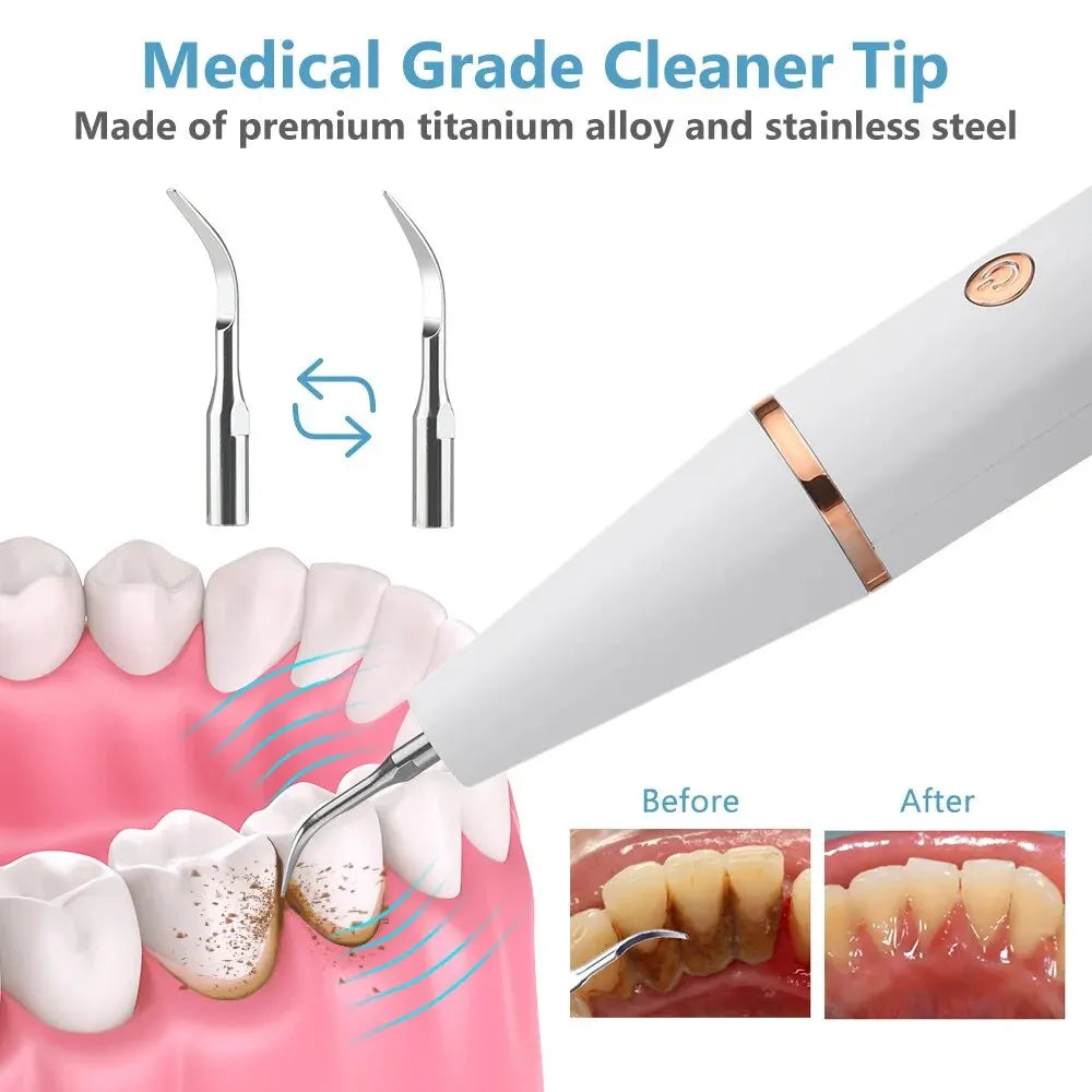 Lisslune | Ultrasonic Teeth Cleaning Device | 38 kHz Ultrasound, LED Light & USB Fast Charging for Home Dental Care