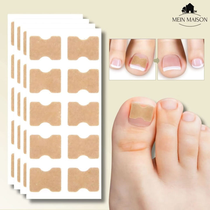 Lisslune | FixaNail – Painless nail correction for ingrown & deformed nails