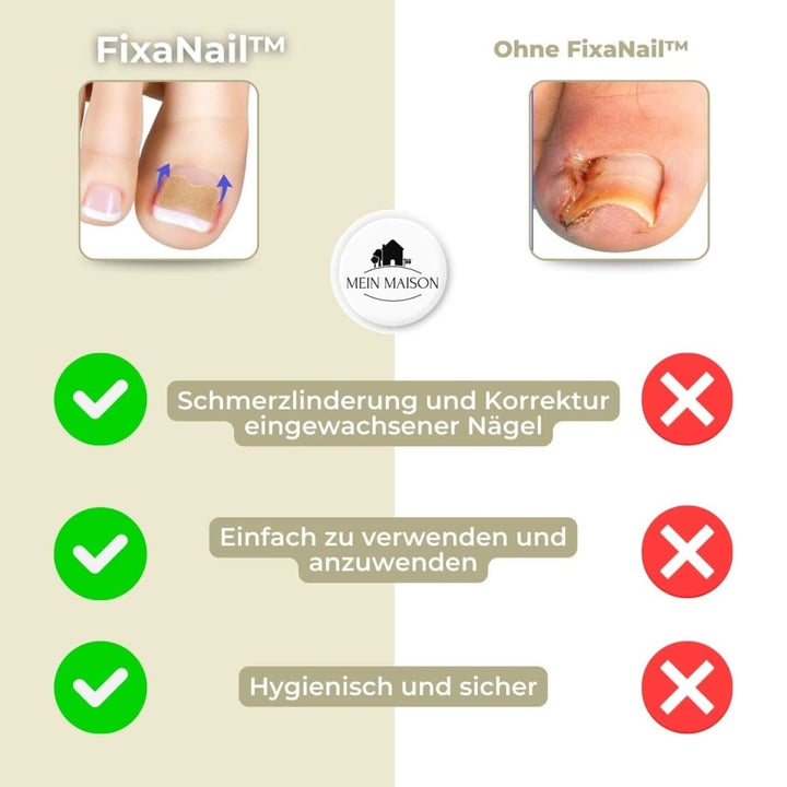 Lisslune | FixaNail – Painless nail correction for ingrown & deformed nails