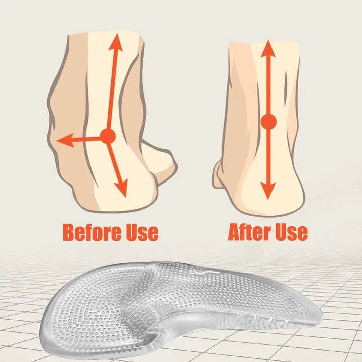 Lisslune | Orthopedic Gel Insoles for supportive arch support