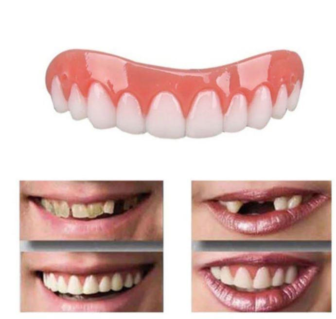 Lisslune | Artificial dental prosthesis for a perfect smile