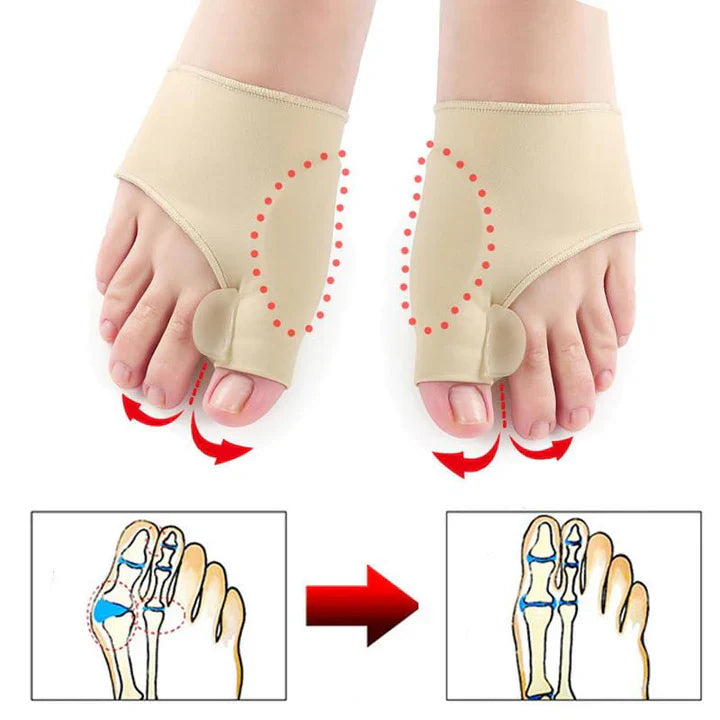 Lisslune | Hallux-Valgus-Correction Protection (1 Pair)