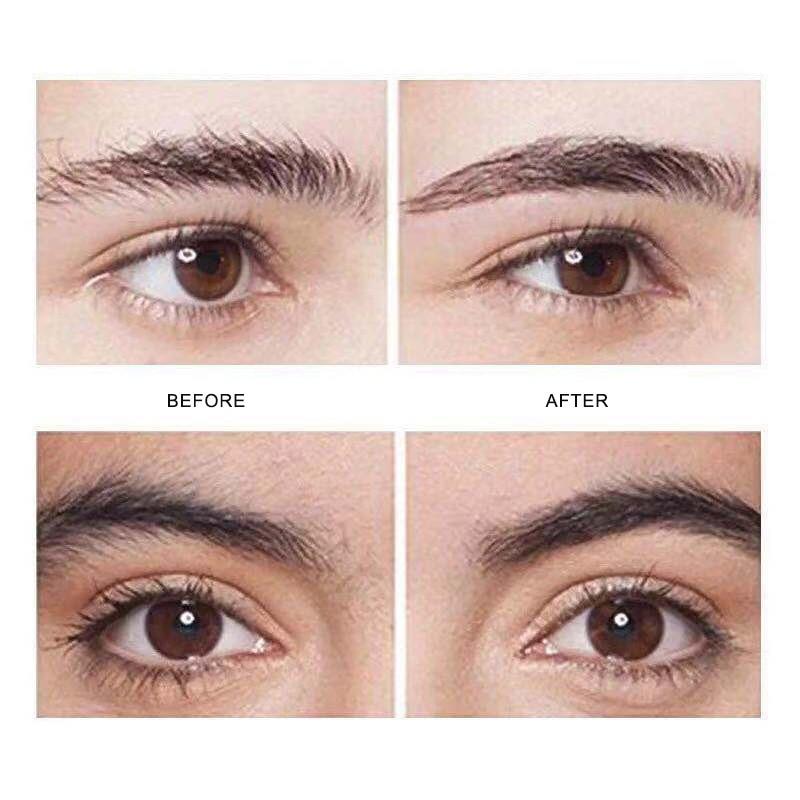 Lisslune | Flawless Facial Hair Remover