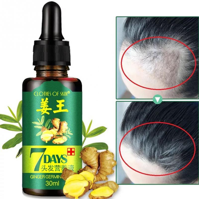 Lisslune | Hair Regrow Oil | 7 Day Hair Regrowth Ginger Serum