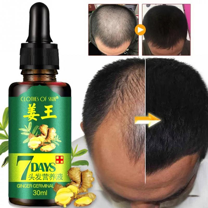 Lisslune | Hair Regrow Oil | 7 Day Hair Regrowth Ginger Serum