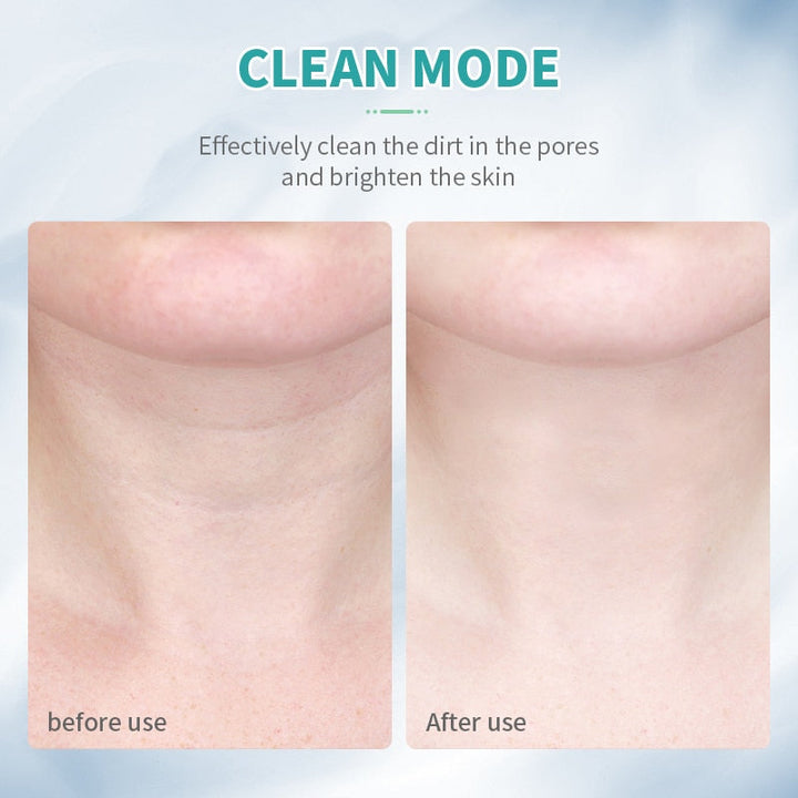 Lisslune | Beauty Skin Device