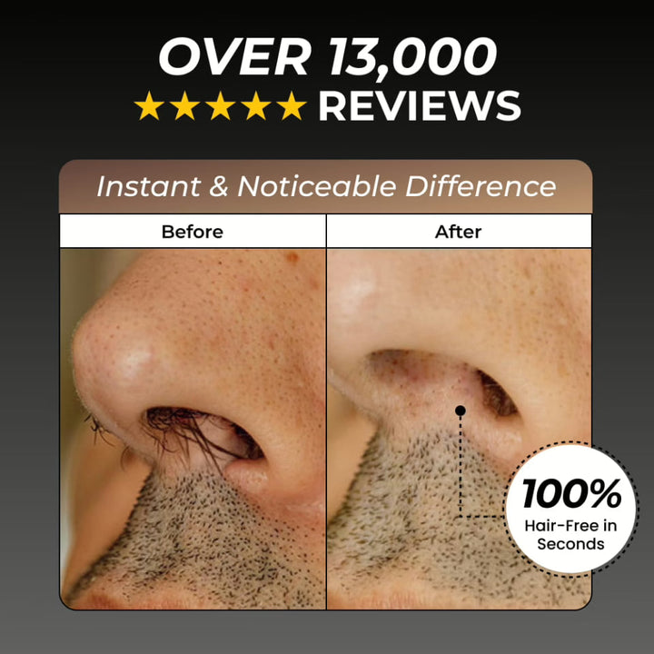 Lisslune | Onyx Edge - Best Nose Hair Cutters for Men | USB-C Rechargeable, Painless & Quiet with a Waterproof Head for Travel & Daily Grooming