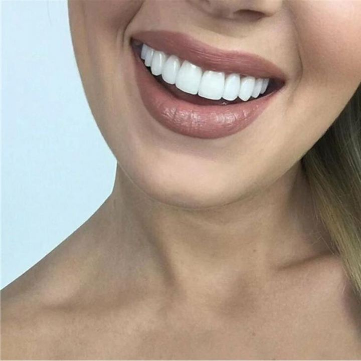 Lisslune | PerfectSnap | Always the perfect smile