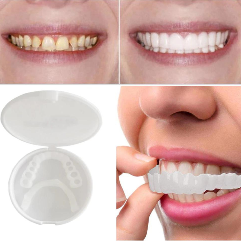 Lisslune | PerfectSnap | Always the perfect smile