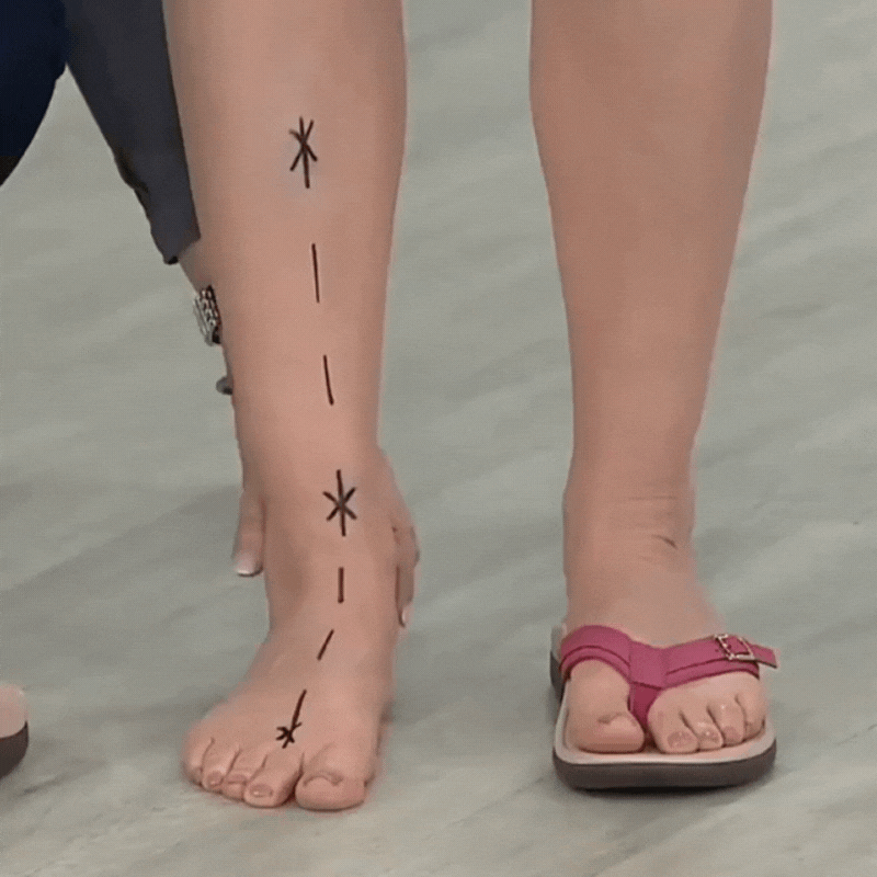 Lisslune | Pylomo Orthopedic Summer Sandals – Pain Relief, Arch Support & Posture Correction