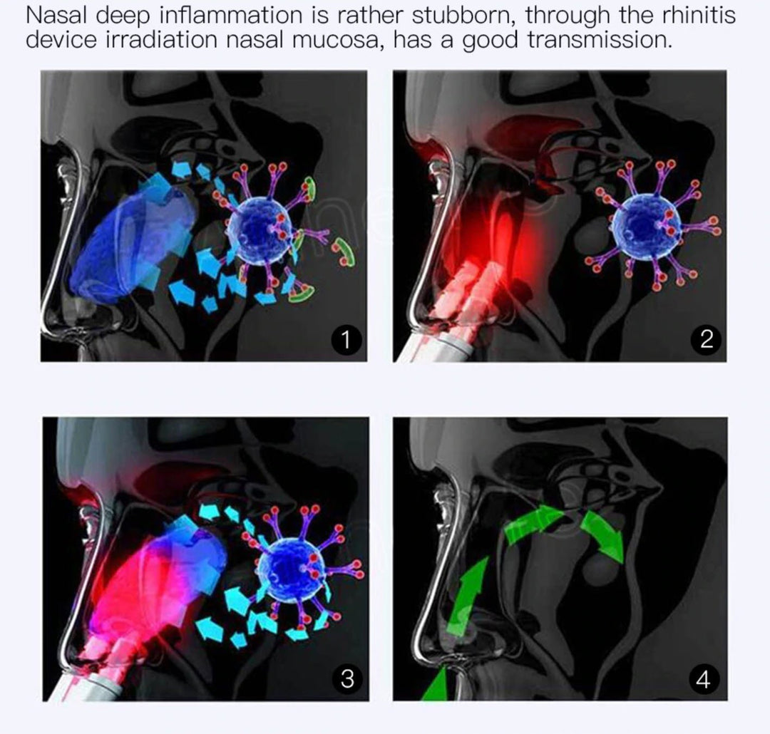 Lisslune | Infrared Rhinitis Therapy Device