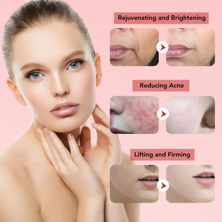 Lisslune | Aetheris™ | Ultrasonic Skin Lifting Tool | Facial Sculpting Device for Anti-Aging & Skin Tightening
