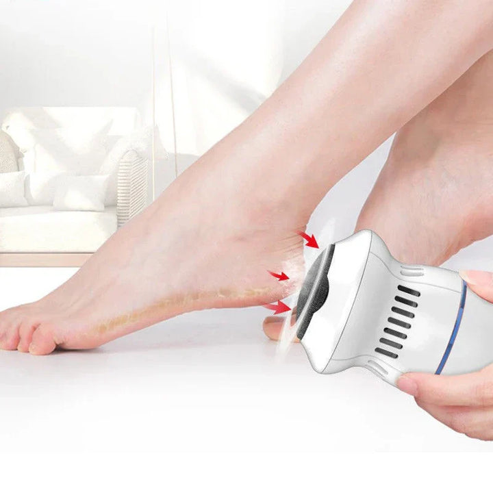 Lisslune | Electric Professional Callus Remover