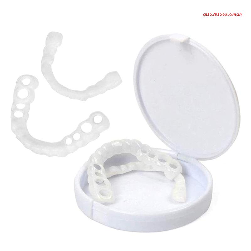 Lisslune | SmileSnap - Always the perfect smile with these veneers