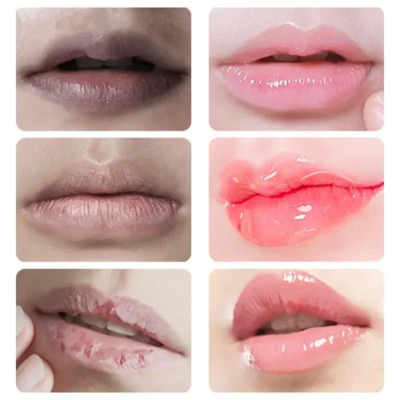 Rynx | Autumn Winter Moisturizing Lip Balm Lip Color Brightening Dark Lips Gloss Oil Scrub Cleanser Moisturizer Korean Makeup