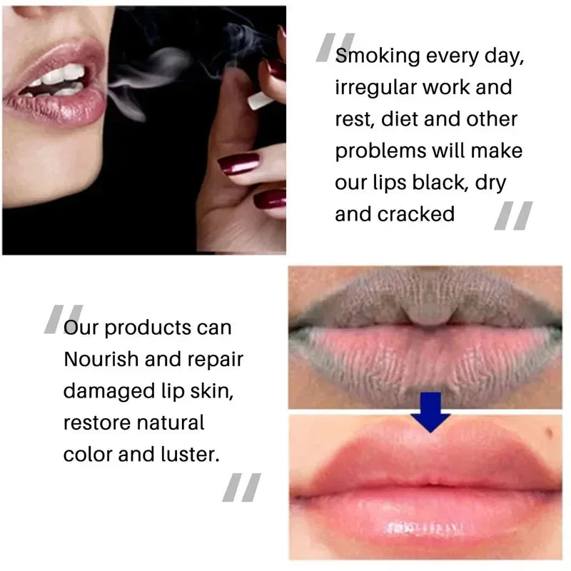 Rynx | Autumn Winter Moisturizing Lip Balm Lip Color Brightening Dark Lips Gloss Oil Scrub Cleanser Moisturizer Korean Makeup