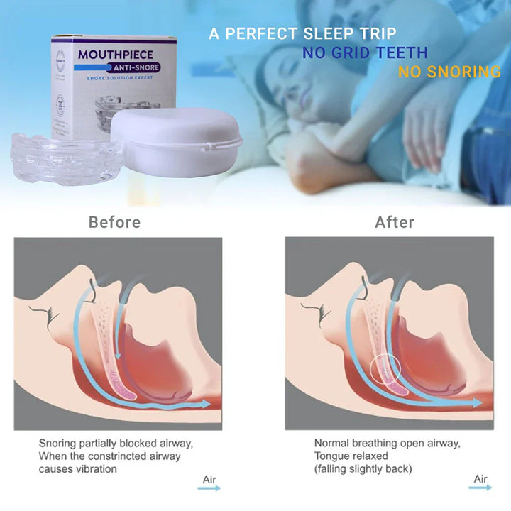 Lisslune | Anti-Snore Mouthpiece